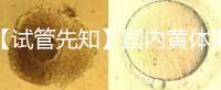 【試管先知】國內黃體期方案經驗緊缺,2點促排弊端需了解