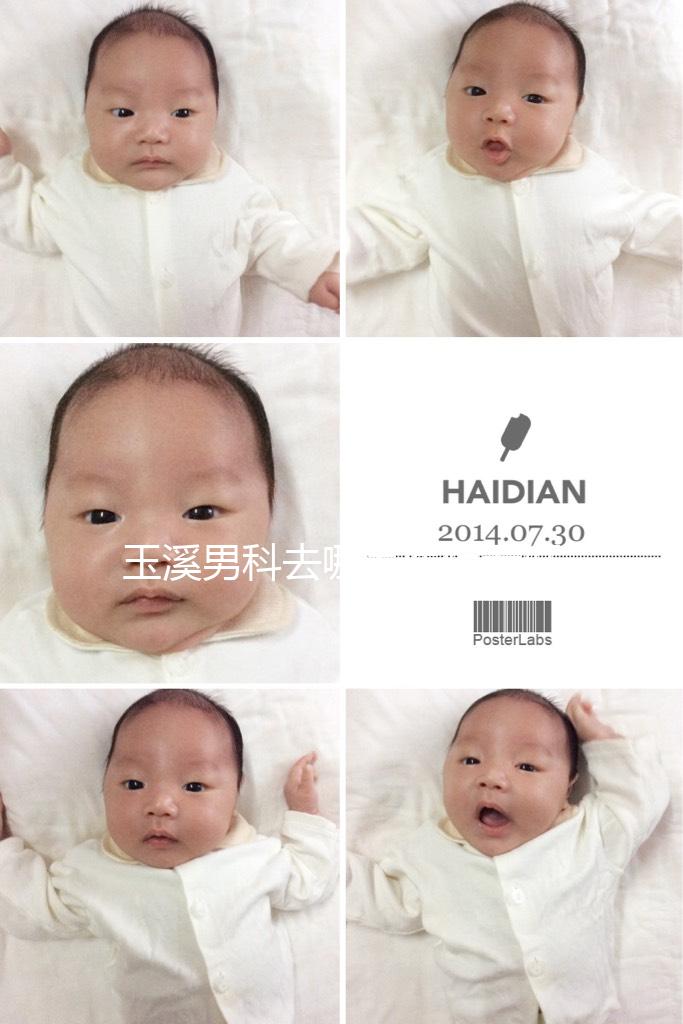 玉溪男科去哪家醫(yī)院看好,怎么選攻略,這個(gè)排行榜不要錯(cuò)過