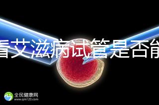 看看艾滋病試管是否能發(fā)現HCG大于150IU/ml或懷孕