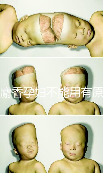 白麝香孕婦不能用有原因,流產、早產…這些危害不得不知