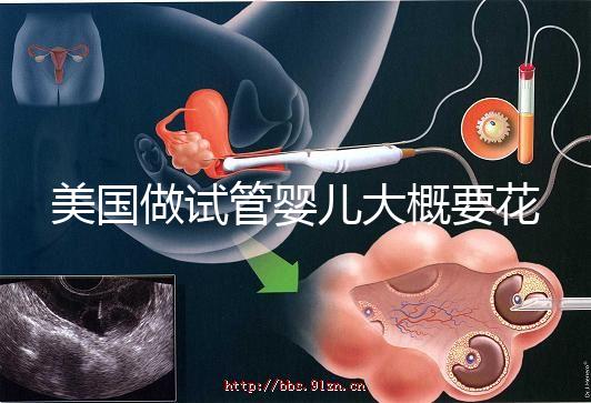 美國(guó)做試管嬰兒大概要花多少錢(qián)?具體支出25w!