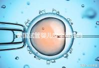 美國試管嬰兒安全可靠嗎？了解基本原理和安全性？