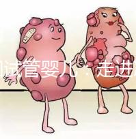 美國試管嬰兒:走進冷凍卵子技術(shù)