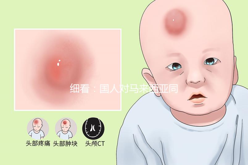 細(xì)看:國人對(duì)馬來西亞同善醫(yī)院試管嬰兒技術(shù)的評(píng)價(jià)