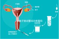 單角子宮試管成功率高嗎？送你5招降低胚胎著床的難度