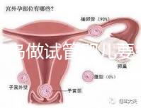 去青島做試管嬰兒要多少錢？