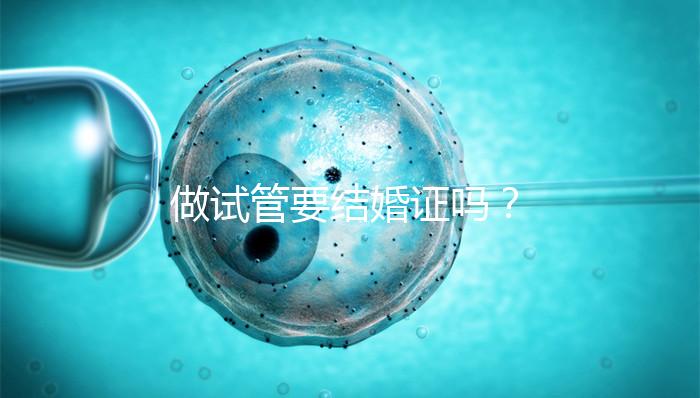 做試管要結婚證嗎？