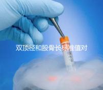 雙頂徑和股骨長(zhǎng)標(biāo)準(zhǔn)值對(duì)照表,各懷孕周數(shù)差異明顯