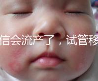 別信會流產了,試管移植后能不能吃胡椒粉聽我說!