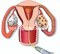 別還不造內(nèi)膜10mm鮮胚容不容易著床,能否移植看這幾點