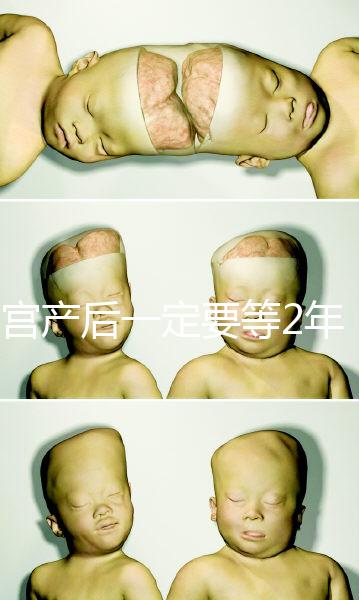 剖宮產后一定要等2年，才能試管嬰兒懷孕嗎？