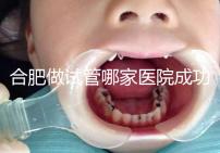 合肥做試管哪家醫院成功率最高(合肥做試管哪家醫院成功率最高的)