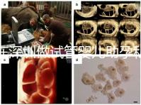 在深圳做試管嬰兒助孕私人機構收費標準是怎樣的