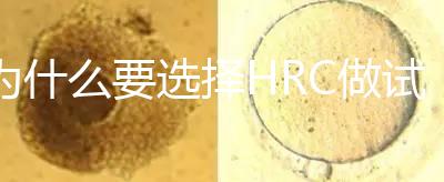 為什么要選擇HRC做試管?這6大優(yōu)勢看完就知道答案