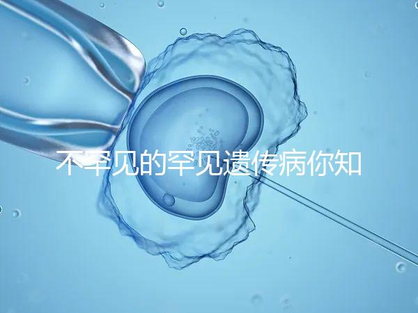 不罕見的罕見遺傳病你知道嗎?帶你認識下特納綜合癥