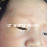 想知道促排期間能不能吃草莓看過來，怎么吃不發(fā)胖有講究