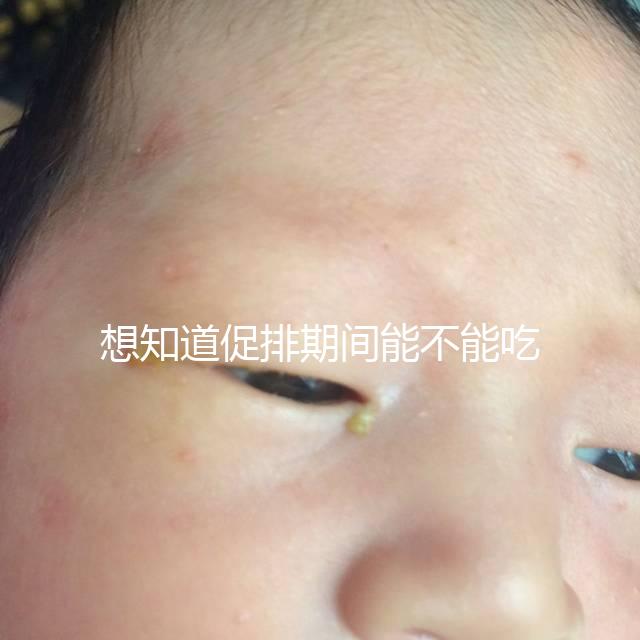 想知道促排期間能不能吃草莓看過(guò)來(lái),怎么吃不發(fā)胖有講究