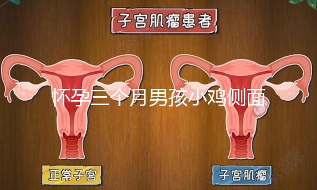 懷孕三個月男孩小雞側(cè)面二維b超圖片分享,原來兩腿間有尖