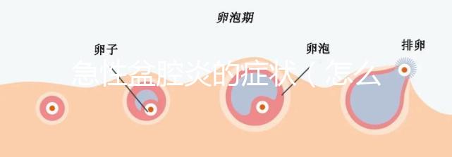 急性盆腔炎的癥狀(怎么判斷是急性盆腔炎)