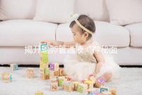 揭開輸卵管通液“神秘面紗”，細(xì)數(shù)其優(yōu)缺點