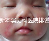 更新本溪男科醫(yī)院排名,不要錯過本溪湖區(qū)top3醫(yī)生的專業(yè)