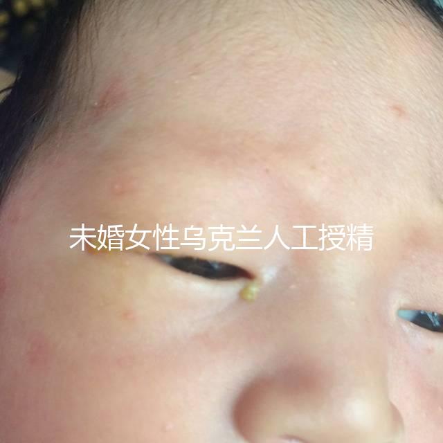 未婚女性烏克蘭人工授精必看!醫(yī)療及生活費用明細預覽