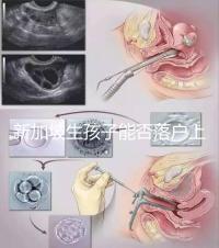 新加坡生孩子能否落戶上海分，@家長:高學歷可以申請