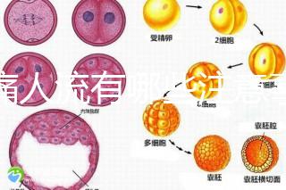 無痛人流有哪些注意事項？