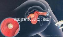 泰國試管嬰兒價位(泰國試管嬰兒價位多少)