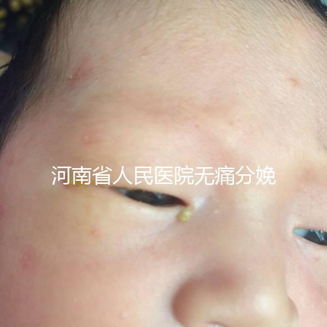 河南省人民醫(yī)院無痛分娩多少錢戳，收費標(biāo)準(zhǔn)60s看懂不踩坑