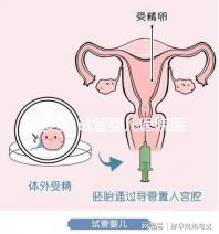 孕多多-試管嬰兒醫(yī)院醫(yī)生_試管嬰兒哪家醫(yī)院好_試管嬰兒全過(guò)程流程注意事項(xiàng)