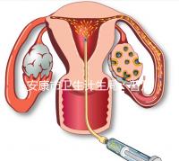 安康市衛生計生局:普及優生優育五項檢查相關知識