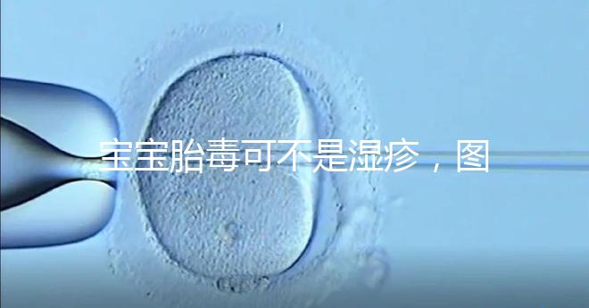 寶寶胎毒可不是濕疹,圖文解讀兩者詳細(xì)區(qū)別