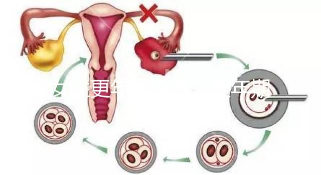 女性更年期保?。ǜ昶趮D女保健健康宣教）