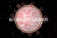 胎兒留級的四大原因找到了!多半和媽媽太懶不運動有關系