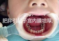 肥胖引起子宮內(nèi)膜增厚,怎么治療在于患者年齡