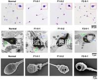 西華做試管嬰兒費用-西華醫院試管嬰兒花費明細表
