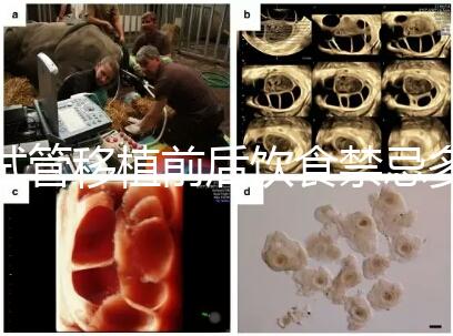 試管移植前后飲食禁忌多，十大不利于胚胎著床的水果別亂吃