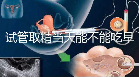 試管取精當天能不能吃早餐喝水的答案來咯咯,好不好一看就知道了?