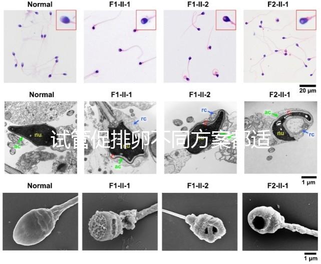 試管促排卵不同方案都適合哪些人?如何監測排卵?