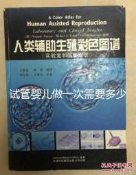 試管嬰兒做一次需要多少錢