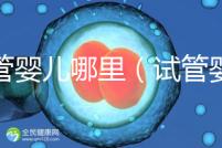 試管嬰兒哪里(試管嬰兒哪里做的最好的醫院)