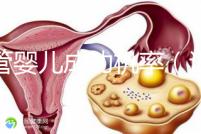 試管嬰兒成功機(jī)率(試管嬰兒成功機(jī)率有多少)