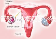 試管嬰兒大概花多少錢(試管嬰兒大概花多少錢費用)