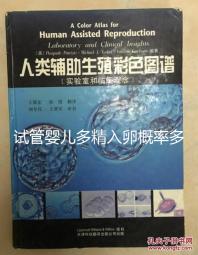 試管嬰兒多精入卵概率多少難說，比正常配對低別瞎操心