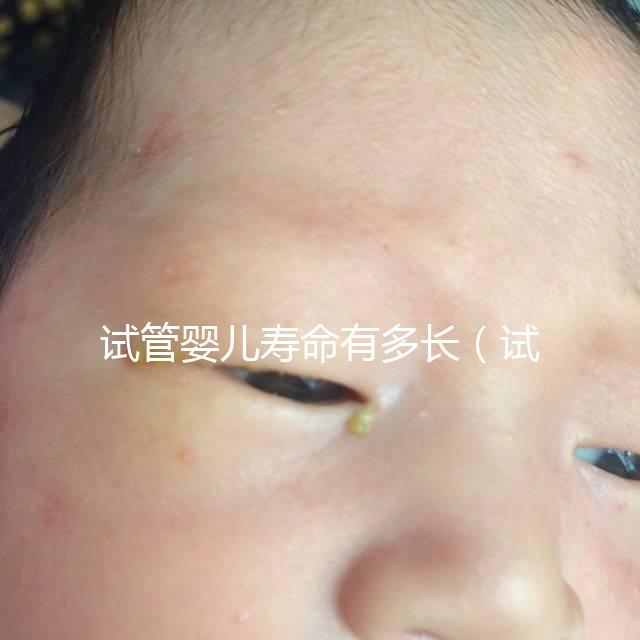 試管嬰兒壽命有多長(試管嬰兒壽命有多長時間)