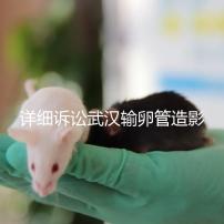 詳細(xì)訴訟武漢輸卵管造影檢查多少錢,能否報(bào)銷,不要錯(cuò)過(guò)