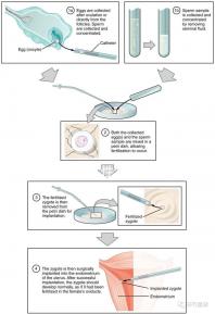 貴陽單身女性禁止凍卵？持“三證”已婚女性就能凍卵