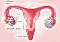 風濕關節炎（風濕關節炎的癥狀有哪些）