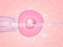 高齡能做試管嬰兒?jiǎn)幔坎皇窍胱鼍湍茏龅脻M足這5個(gè)條件
